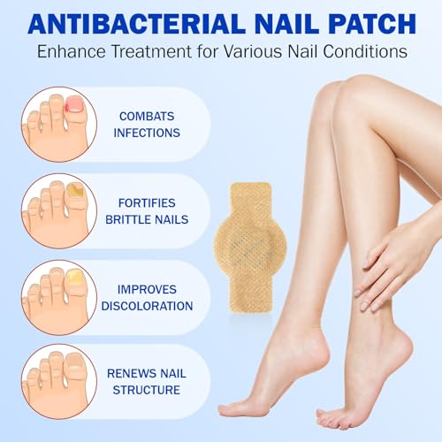 Toenail Fungus Treatment Extra Strength Nighttime Renewal Fungal Nail Patches - 21 Patch - Overnight Repair for Nail Fungus Damage, 8-Hour Treatment Restores Healthy Appearance (21 Count (Pack of 3))