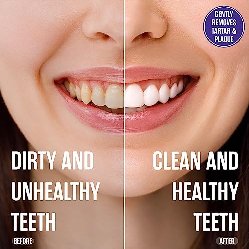 SprinJene Fluoride Free Toothpaste for Sensitive Teeth & Gum Fresh Breath Helps Dry Mouth Natural Non Fluoride Toothpaste for Adult SLS Free, Toxic Preservative Free with Black Seed Oil & Zinc 2 Pack