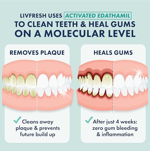 Toothpaste Gel, Clinically Proven to Remove Plaque 250% Better, Improves Gum Health 190% Better, Prevents & Reduces Tartar, Freshens Breath, SLS Free Dental Gel, Wintergreen