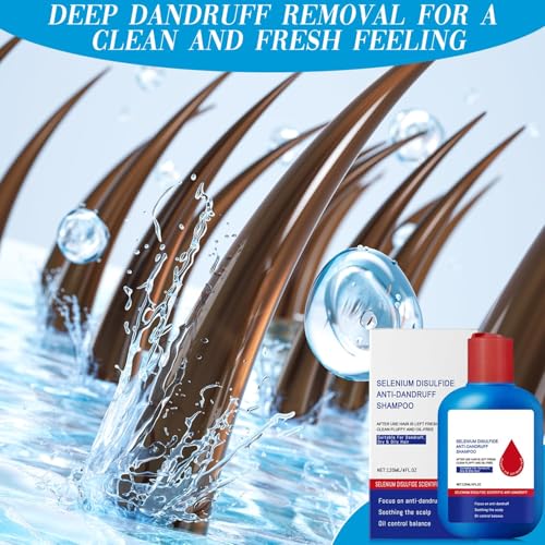 Nippori Anti-Dandruff Shampoo, Oil Control Formula for Men and Women, 300ml